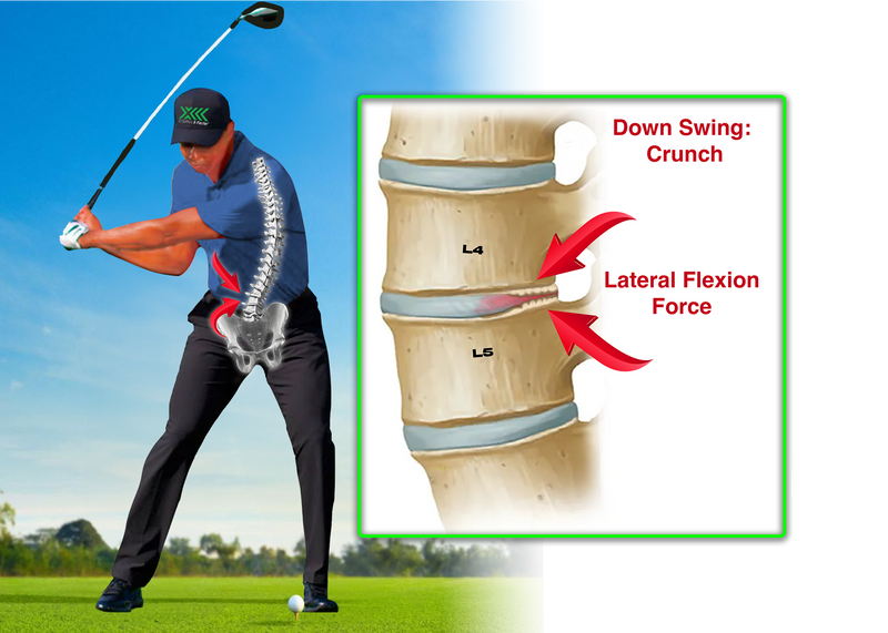 No Golf Back Brace vs X-Factor Belt® Core Alignment System